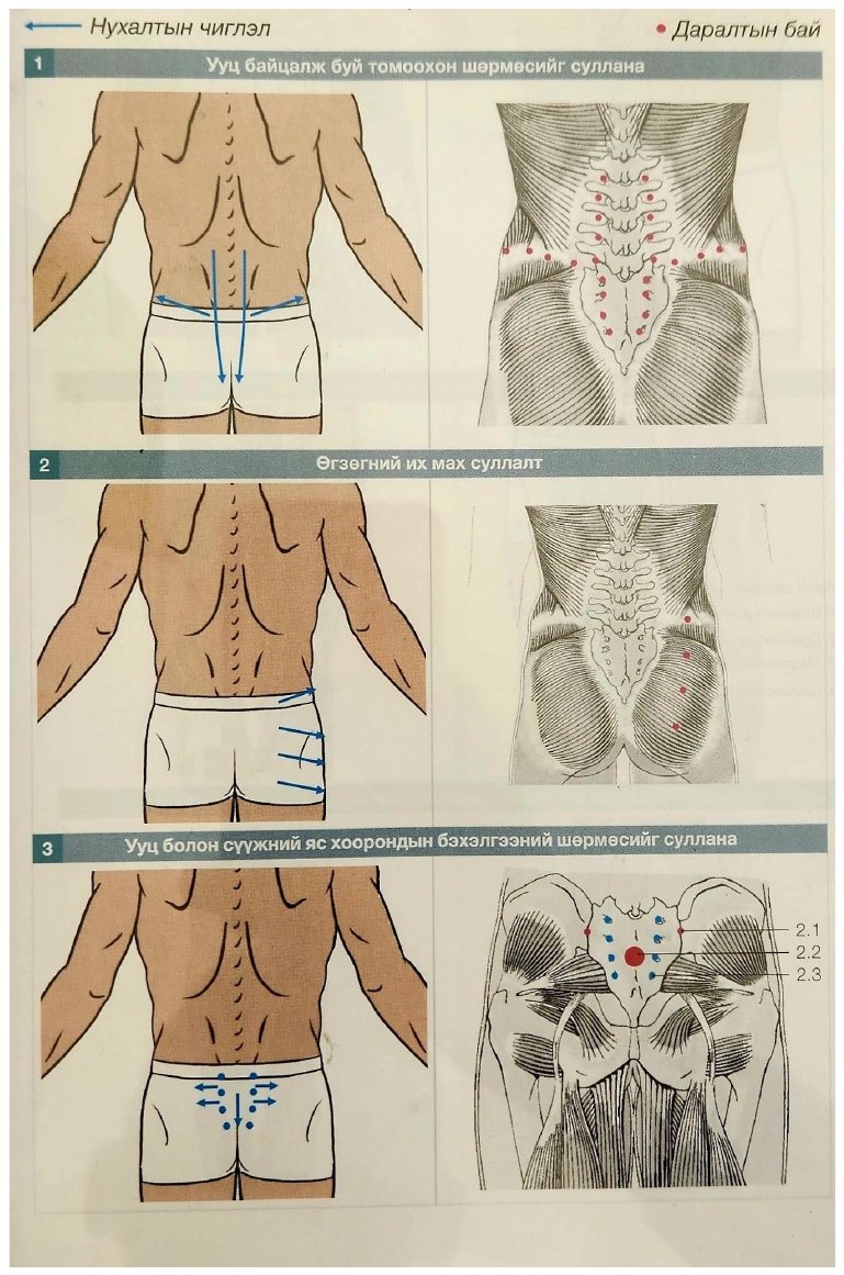 Trajets de baria sur le sacrum, les fessiers et le bassin, vue arrière